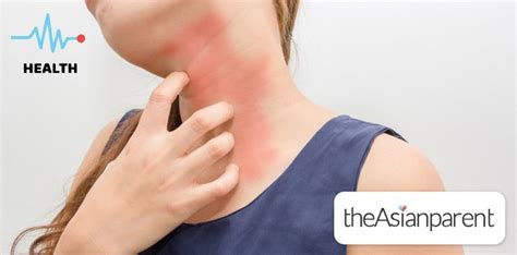 allergy sa sabon panlaba|Allergy Sa Balat: 8 Irritants Na Maaaring Sanhi Ng .
